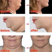 V Shape Slimming Cream Firming Face-lift Remove Masseter Muscle Double Chin Tighten Mandibular Fat Burning Cream Fade Neck Lines - Image 3