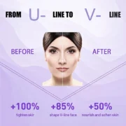 V Shape Slimming Cream Firming Face-lift Remove Masseter Muscle Double Chin Tighten Mandibular Fat Burning Cream Fade Neck Lines - Image 4